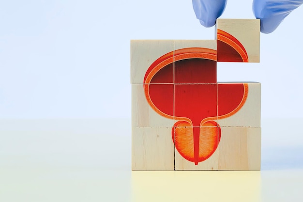 Jak szybko rośnie guz pęcherza moczowego? Objawy i czynniki