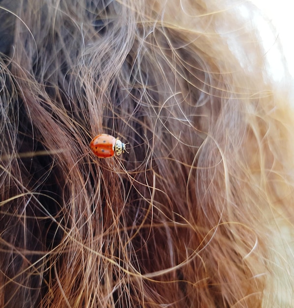 Jak wyglądają wszy? Objawy, leczenie i zapobieganie