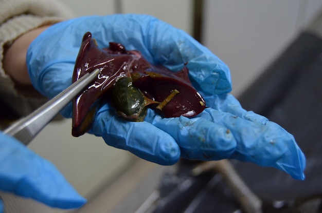 Jak zregenerować wątrobę? Porady i naturalne metody